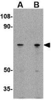 LGI2 antibody