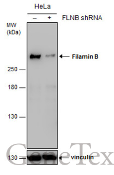 Filamin B antibody [GT1282]