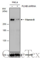 Filamin B antibody [GT1282]