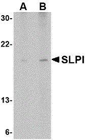SLPI antibody