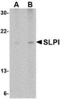 SLPI antibody