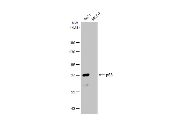 p63 antibody [HL1027]