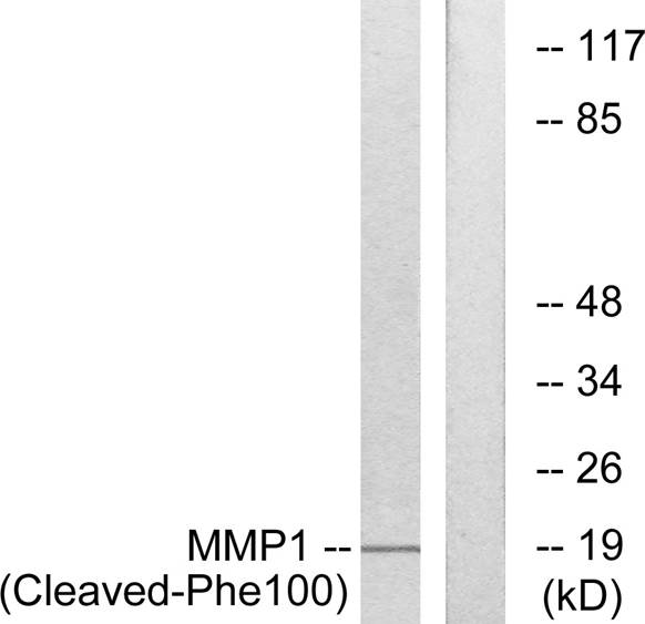 MMP1 (cleaved Phe100) antibody