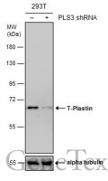 T-Plastin antibody [GT236]