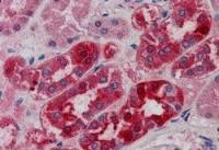 MID2 antibody, C-term