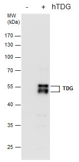 TDG antibody [GT1511]