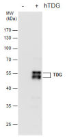 TDG antibody [GT1511]