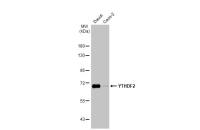 YTHDF2 antibody [HL1355]