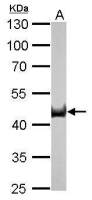 Citrate synthase antibody [GT2061]