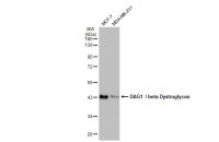DAG1 / beta Dystroglycan antibody [GT9112]