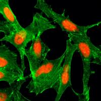 Histone H4K12ac (Acetyl Lys12) antibody [RM202]