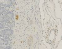 Calcitonin antibody [4]