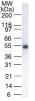 Lck antibody [33D196]