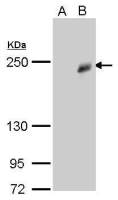 TET3 antibody [GT859]