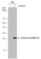 Enterovirus D68 VP3 antibody [GT1665]