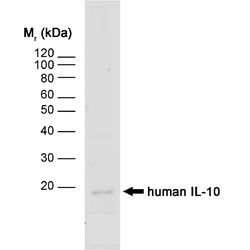IL10 antibody [JES3-12G8]