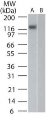 DNMT3A antibody [64B814.1]