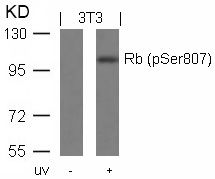 Rb (phospho Ser807) antibody