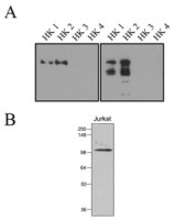 Hexokinse 1, 2 antibody [1A7]