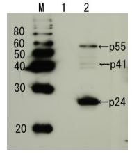 HIV1 p24 antibody