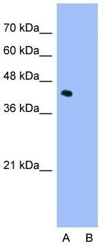 ILF2 antibody, C-term