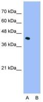 ILF2 antibody, C-term