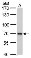 UVSSA antibody [GT816]