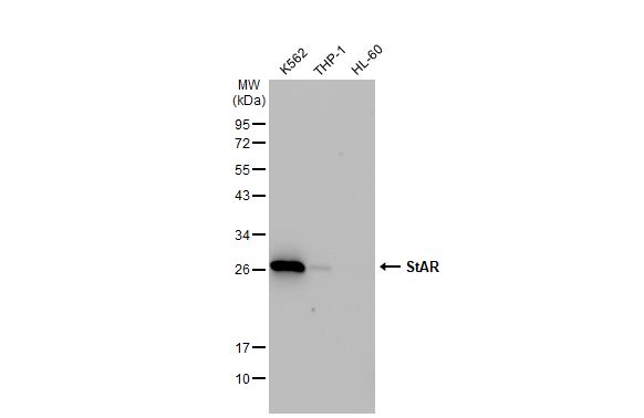 StAR antibody [HL1362]