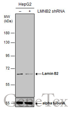 Lamin B2 antibody [GT144]