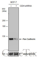 pan Cadherin antibody [GT2610]