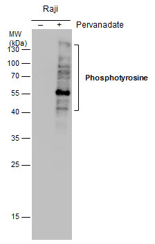 Phosphotyrosine antibody [GT0021]