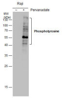 Phosphotyrosine antibody [GT0021]