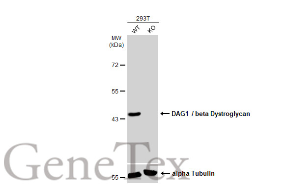 DAG1 / beta Dystroglycan antibody [GT835]