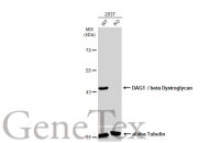 DAG1 / beta Dystroglycan antibody [GT835]