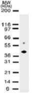 DNMT2 antibody [102B1259.2]