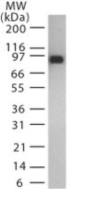 Bacillus anthracis Lethal Factor antibody [5F502.2]