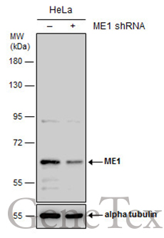 ME1 antibody [GT736]