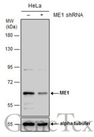 ME1 antibody [GT736]