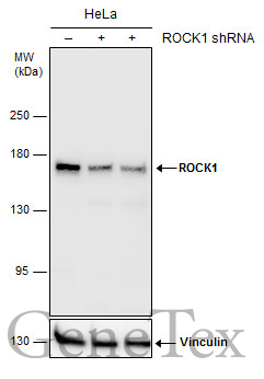 ROCK1 antibody [GT464]