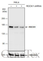 ROCK1 antibody [GT464]