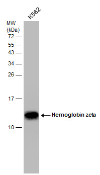 Hemoglobin zeta antibody [GT1544]