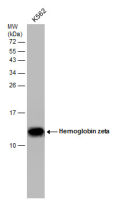 Hemoglobin zeta antibody [GT1544]