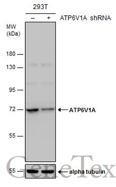 ATP6V1A antibody [GT811]