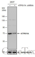 ATP6V1A antibody [GT811]