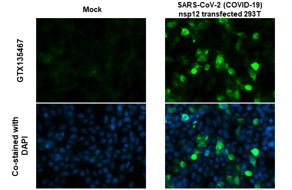 SARS-CoV-2 (COVID-19) nsp12 antibody