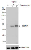 SQSTM1 / P62 antibody [GT381]