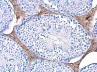 Triosephosphate isomerase antibody [GT3711]