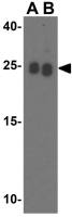 RPA Interacting Protein antibody
