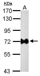 Helicobacter pylori urease B antibody [GT1263]