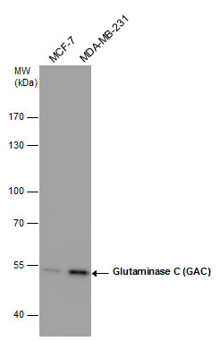 Glutaminase C (GAC) antibody [GT1075]